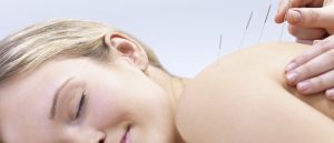 The Science of Dry Needling