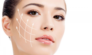 thread facelift Melbourne