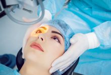 Everything You Must Know About Cataract Surgery