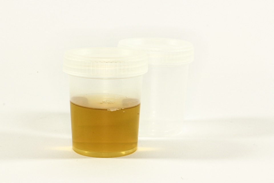 Synthetic urine